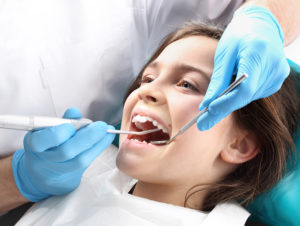 dental-sealants-for-children