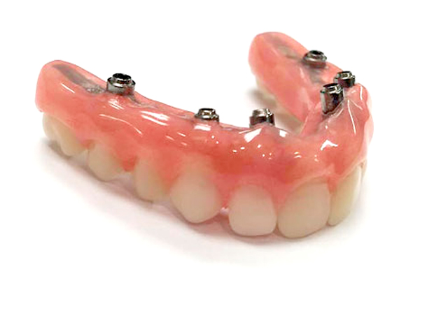 denture stabilization