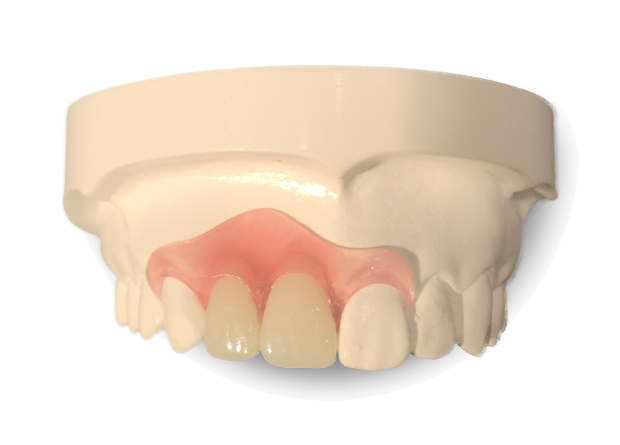 Nesbit Partial dentures