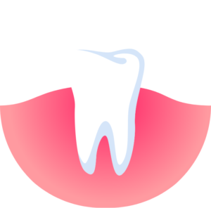 Our board-certified periodontist specializes in preventing, diagnosing, and treating periodontal diseases.