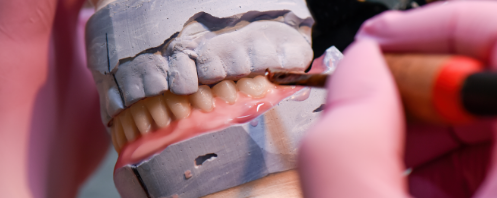 Dental lab Same-Day Dentures Repairs & Relines