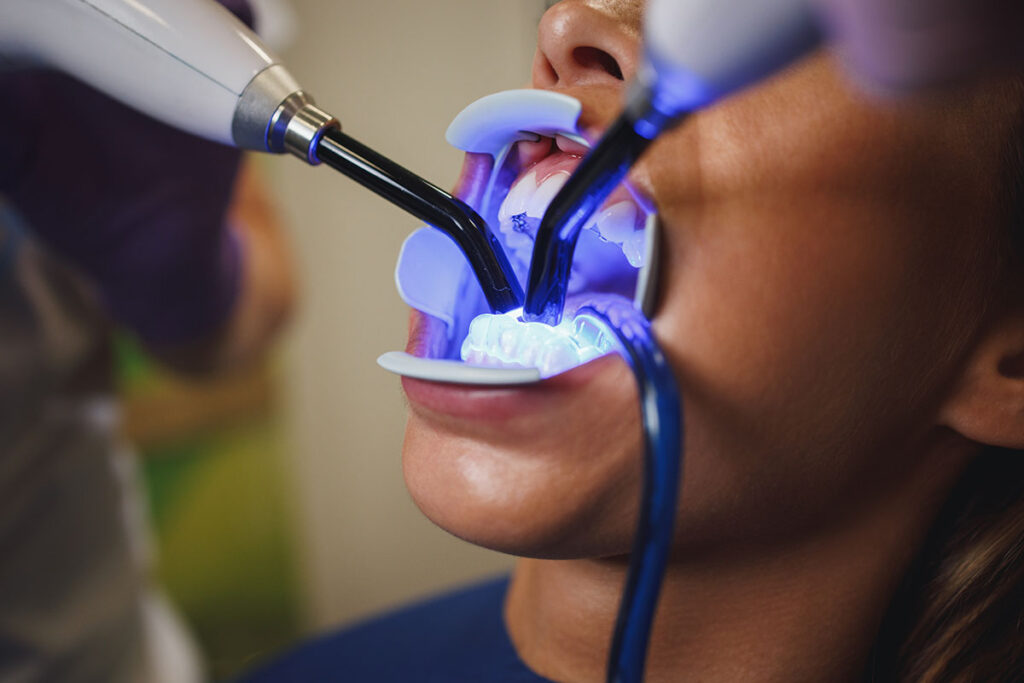 Modern Dental Technology, dental laser, at Shine Dental Associates